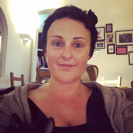 Talking about alopecia…