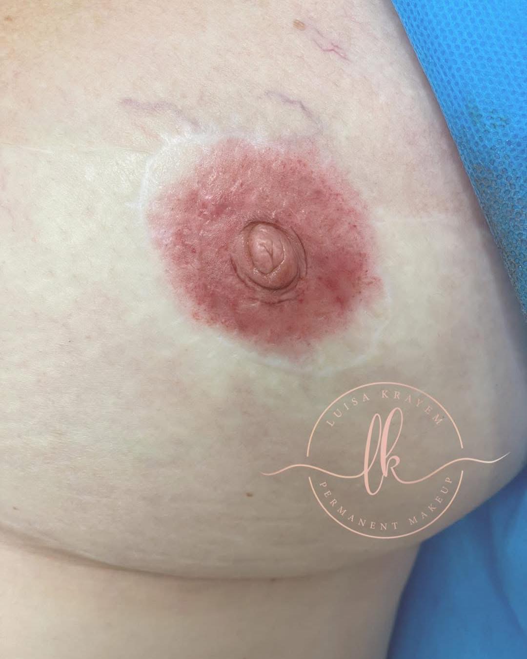 All about 3D Areola Tattoing