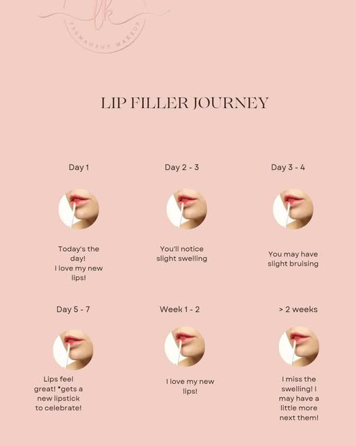 Lip Filler Timeline!