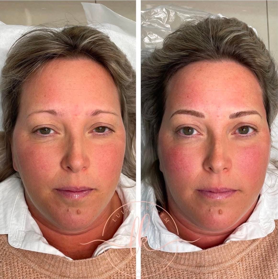 What to Expect at Your Permanent Makeup Consultation