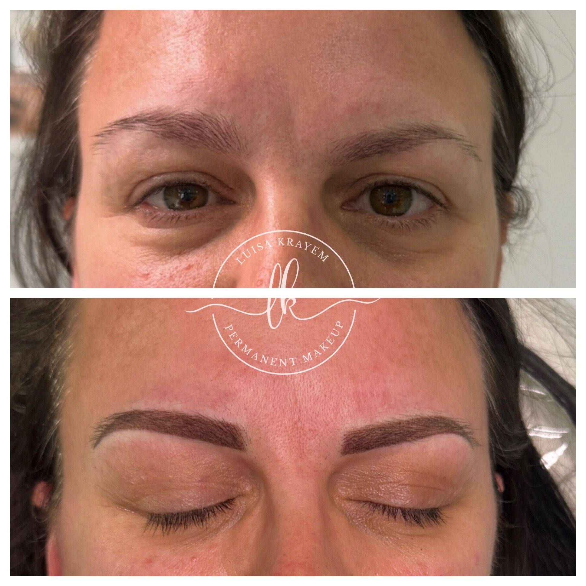 How Permanent Makeup Can Help After Bell’s Palsy