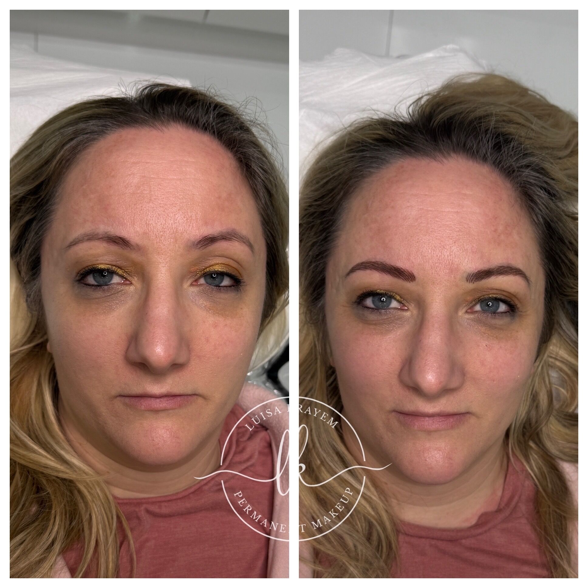 Brow Correction in the Cotswolds: A Thoughtful Approach to Previous Brow Work